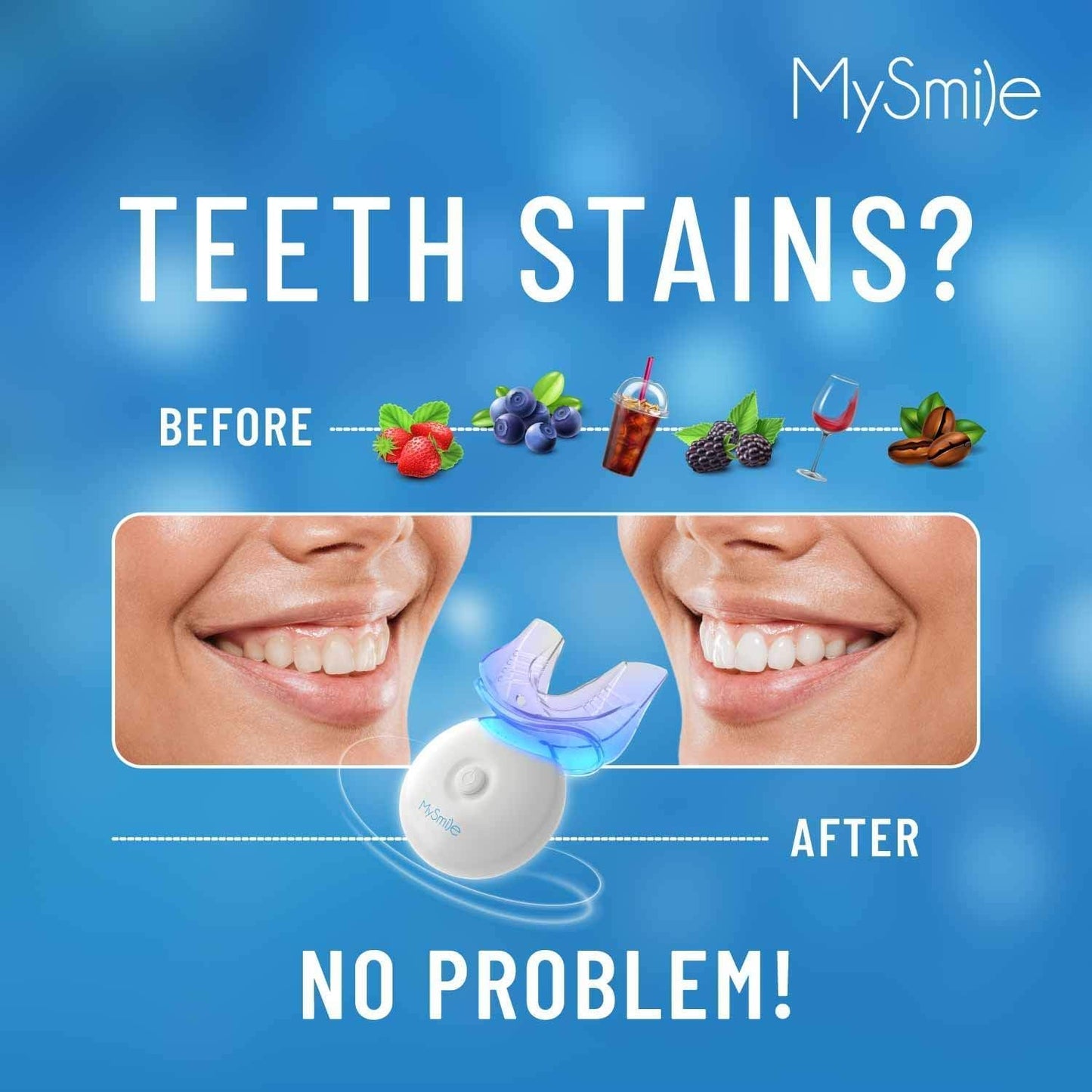 Kit de Blanqueamiento Dental MySmile con Luz LED